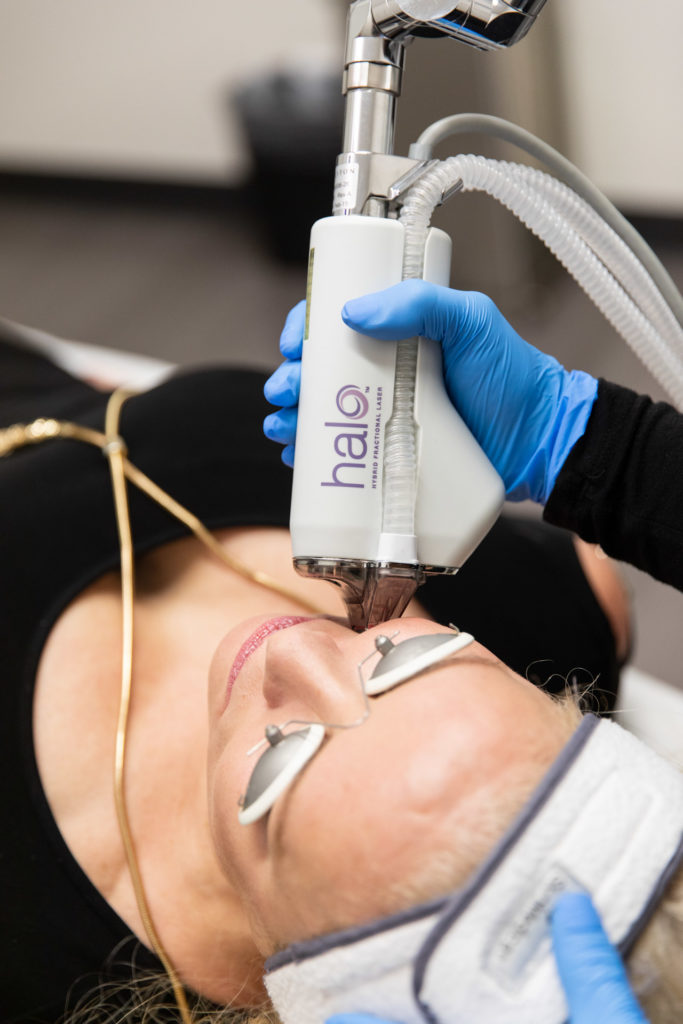 Halo procedure