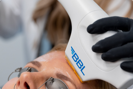 BBL Treatment